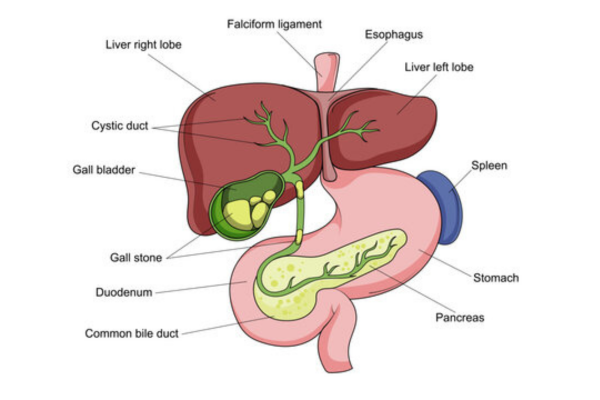 laparoscopic cholecystectomy cholelithiasis
