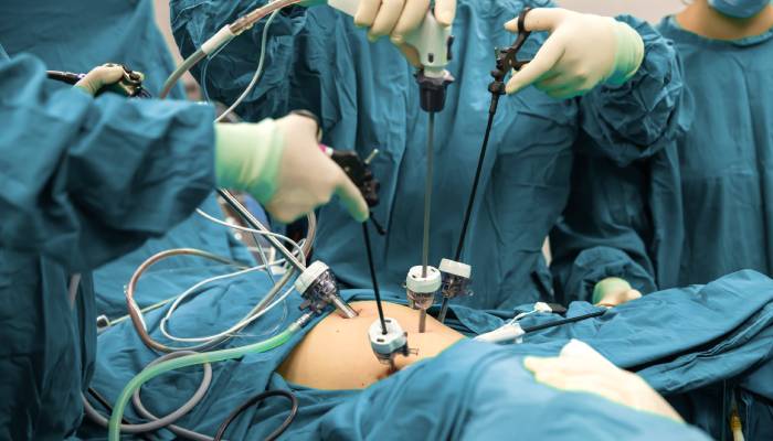 Kidney stones laparoscopy